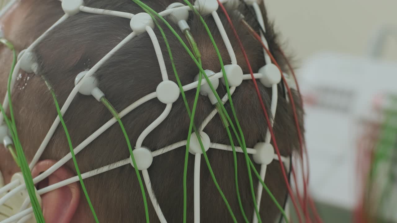 pruebas cerebrales del paciente utilizando la encefalografía en el centro médico