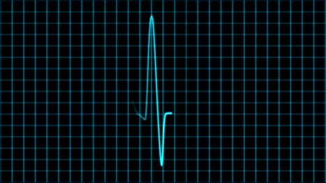 cardiogram cardiograph oscilloscope screen loop 4k