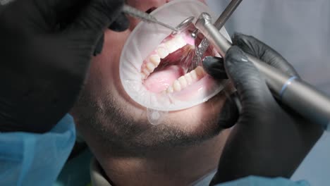 teeth whitening procedure. tooth whitening gel. dentist does the whitening procedure