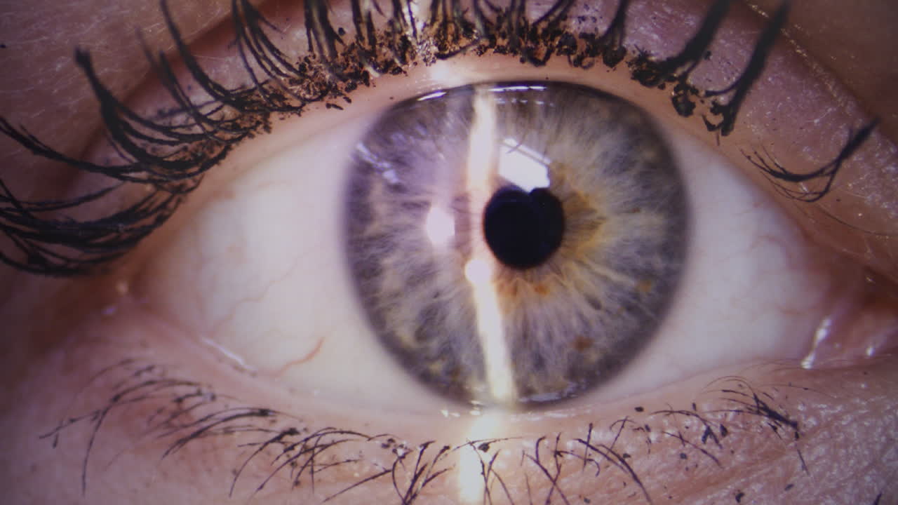 Eye Retina Examination Close-up