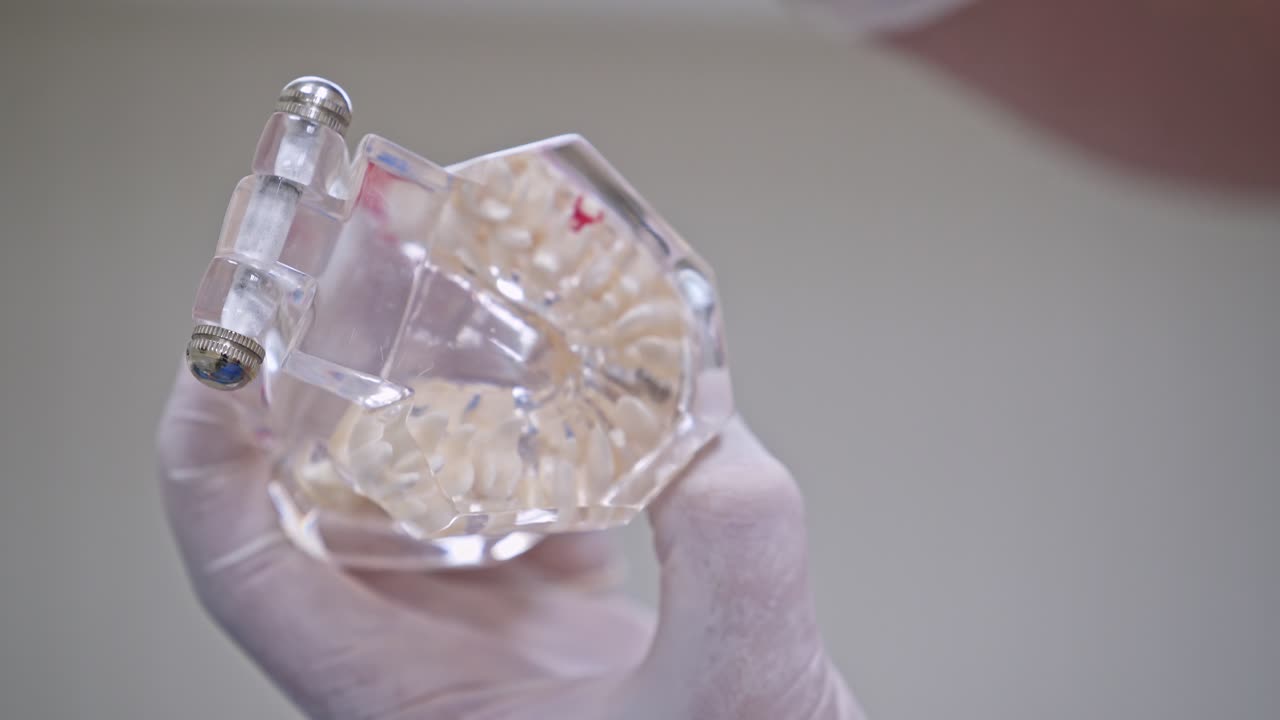 Doctor shows on a plastic jaw sample or model different methods of teeth treatment. Modern dental clinic background. Health concept. White medical gloves on male doctor's hands.