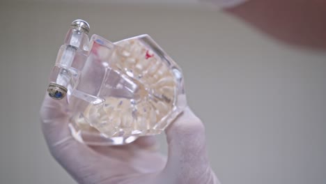 doctor shows on a plastic jaw sample or model different methods of teeth treatment. modern dental clinic background. health concept. white medical gloves on male doctor's hands.