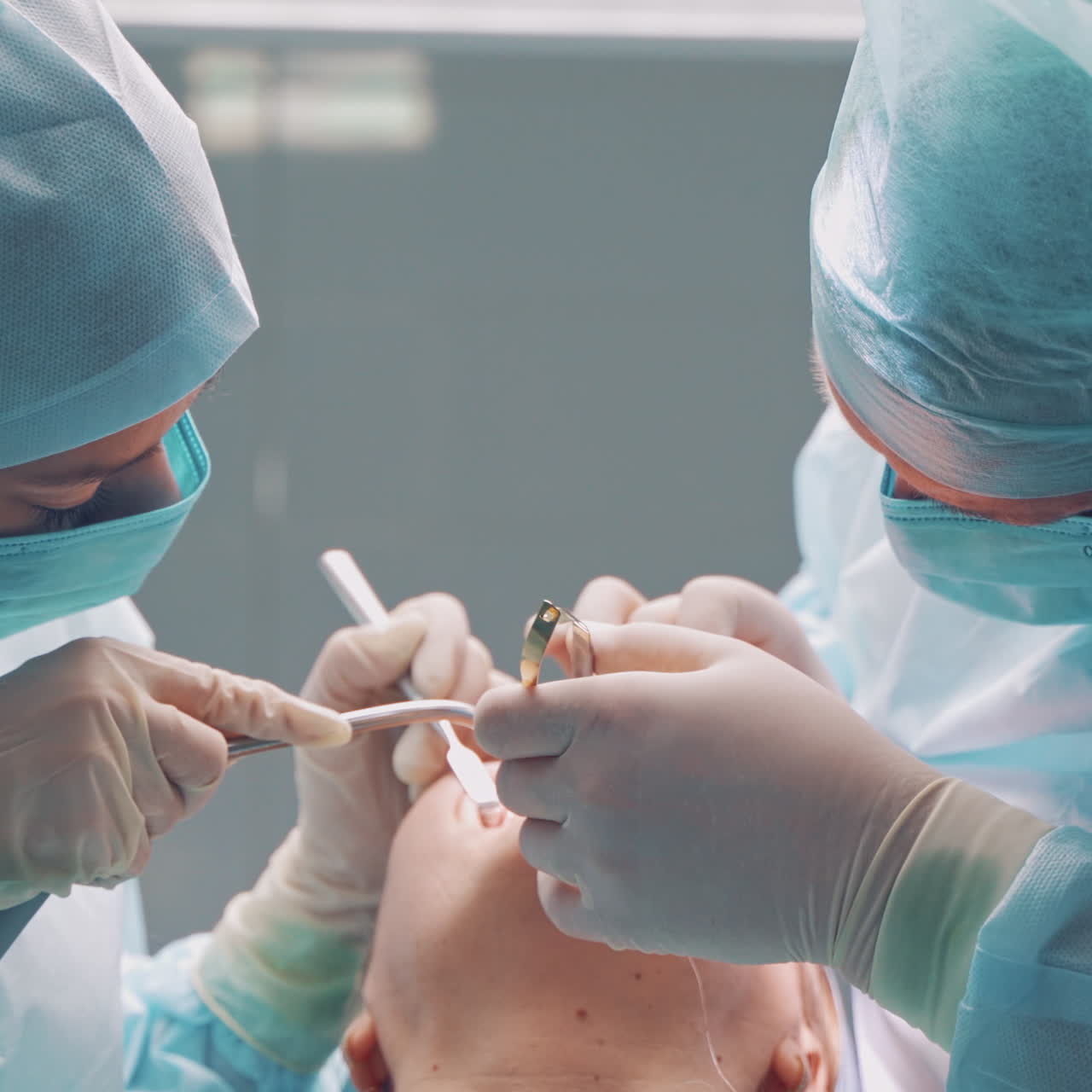 Dental implant surgery. Dentists during surgery for implant placement