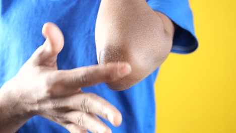 boy applying petroleum jelly on elbow ,