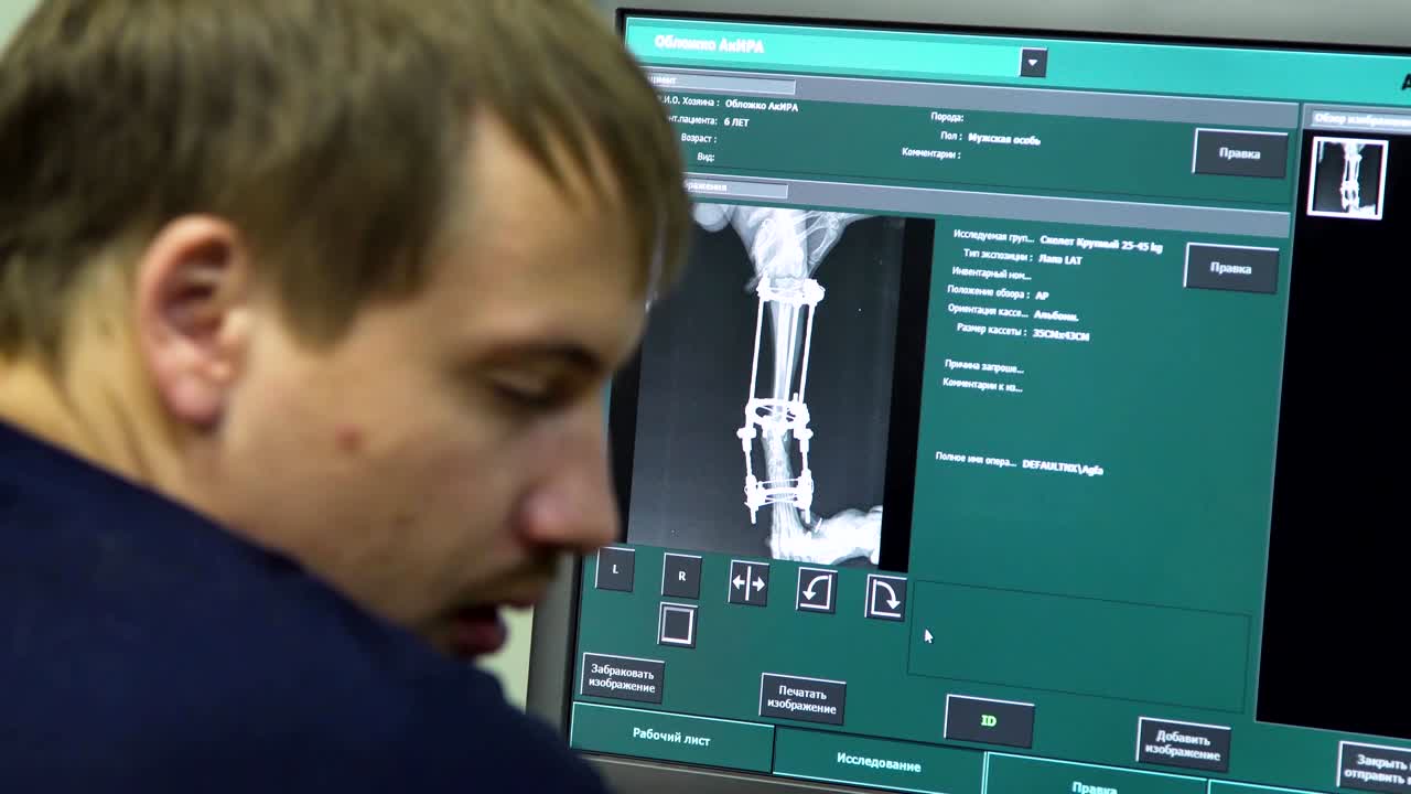 병원 에서 스레이 를 보는 의사