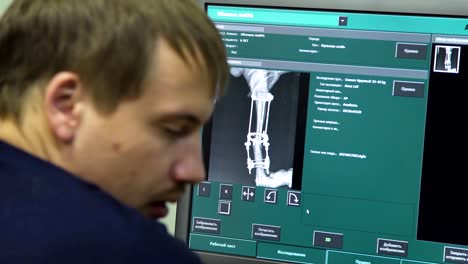 un médico mirando una radiografía en un hospital