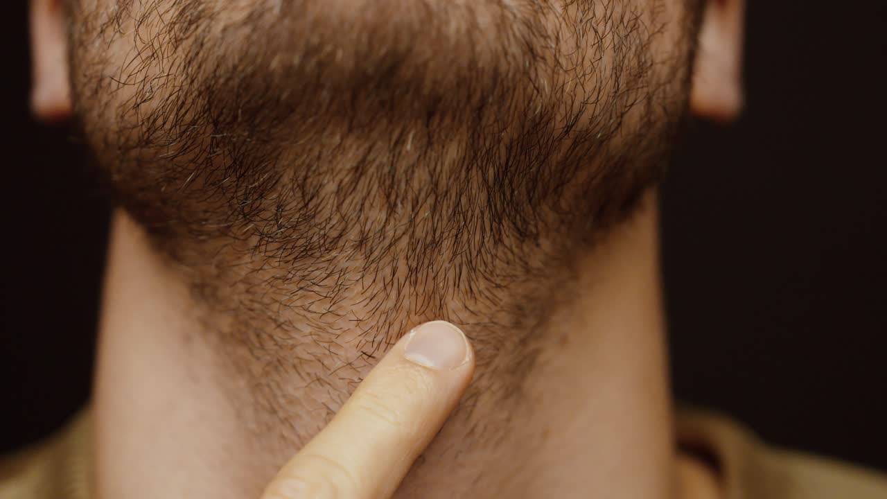 Close-up of a man’s unshaved beard and neck without clean contours. Concept of grooming, personal care, beard growth, masculinity, and everyday appearance