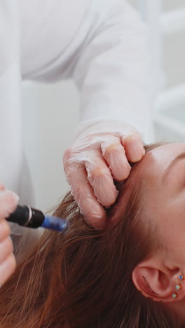 Tricólogo-Realizando-Procedimientos-De-Regeneración-Del-Cabello-Femenino,-Microagujas-Dermapen,-Inyecciones-De-Vitaminas