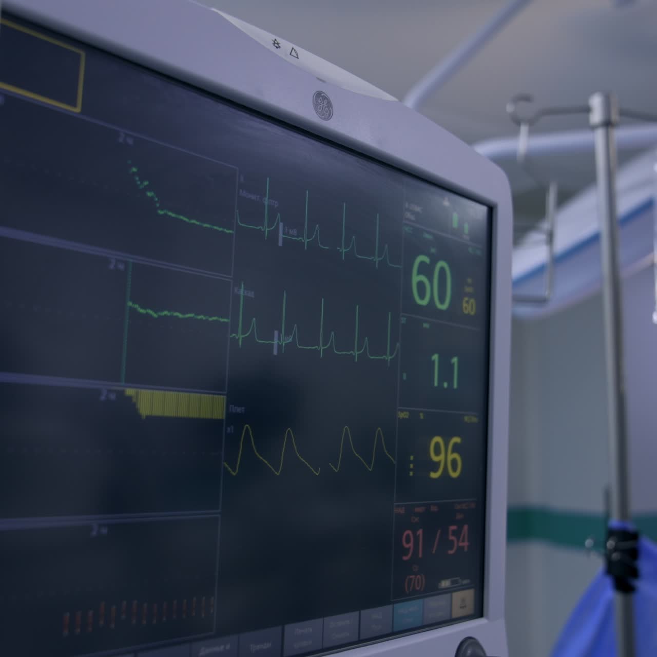 Frequenza cardiaca e polso di un paziente durante un intervento. Parametri delle condizioni di salute sullo schermo nero. Medici al lavoro sullo sfondo