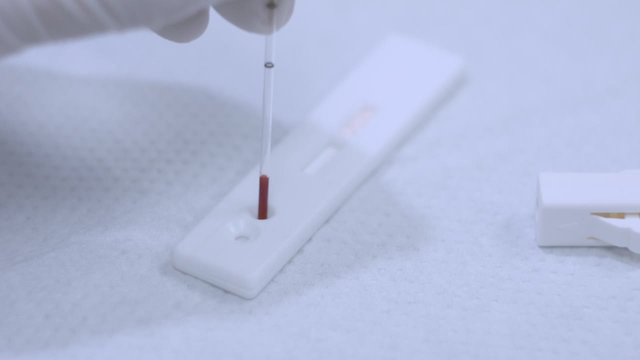 Blood sample drop to analyzer. Closeup of blood test process