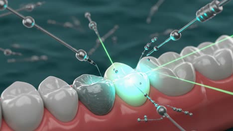 an innovative dental procedure: advanced technology in action for filling cavities with laser precision on the tooth surface in a future-oriented treatment approach