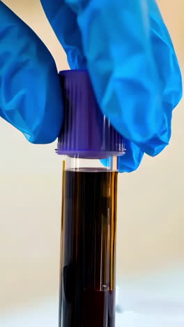 a person is holding a blood sample in a blue glove
