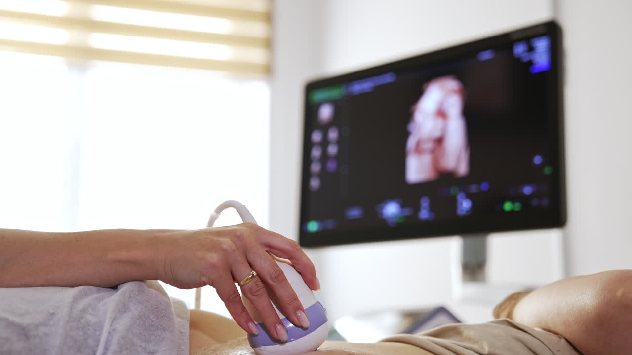 ecografía de una mujer embarazada