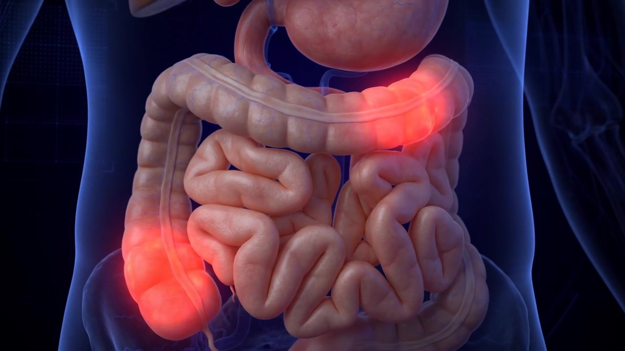 Transparent torso showing liver stomach and intestines with glowing red pain areas across the digestive organs and colon