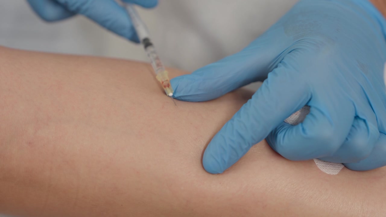 Gloved hands injecting a fine needle into small leg veins during vein treatment