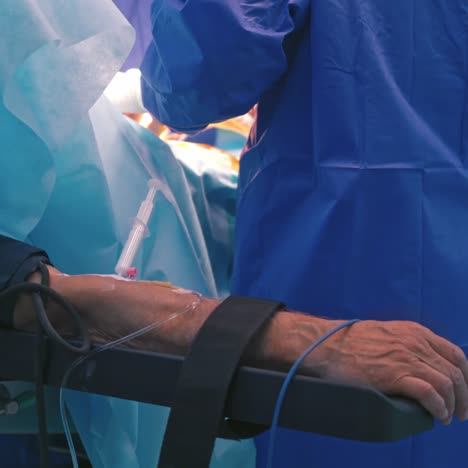 patient's hand with tubes and bands during the operation. surgical process with a group of doctors in the operating room. close-up.