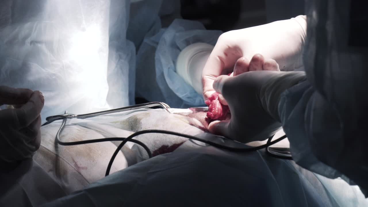 procedimiento quirúrgico