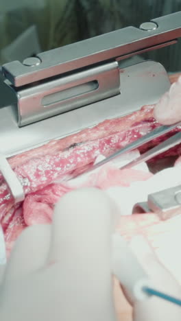 el médico opera con una esponja de ajuste de corazón abierto. el cirujano demuestra precisión durante la cirugía de derivación de la arteria coronaria utilizando instrumentos especializados