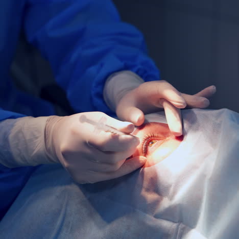 doctor's hands in sterile gloves with syringe. ophthalmologist making an injection into patient's eye. close-up.