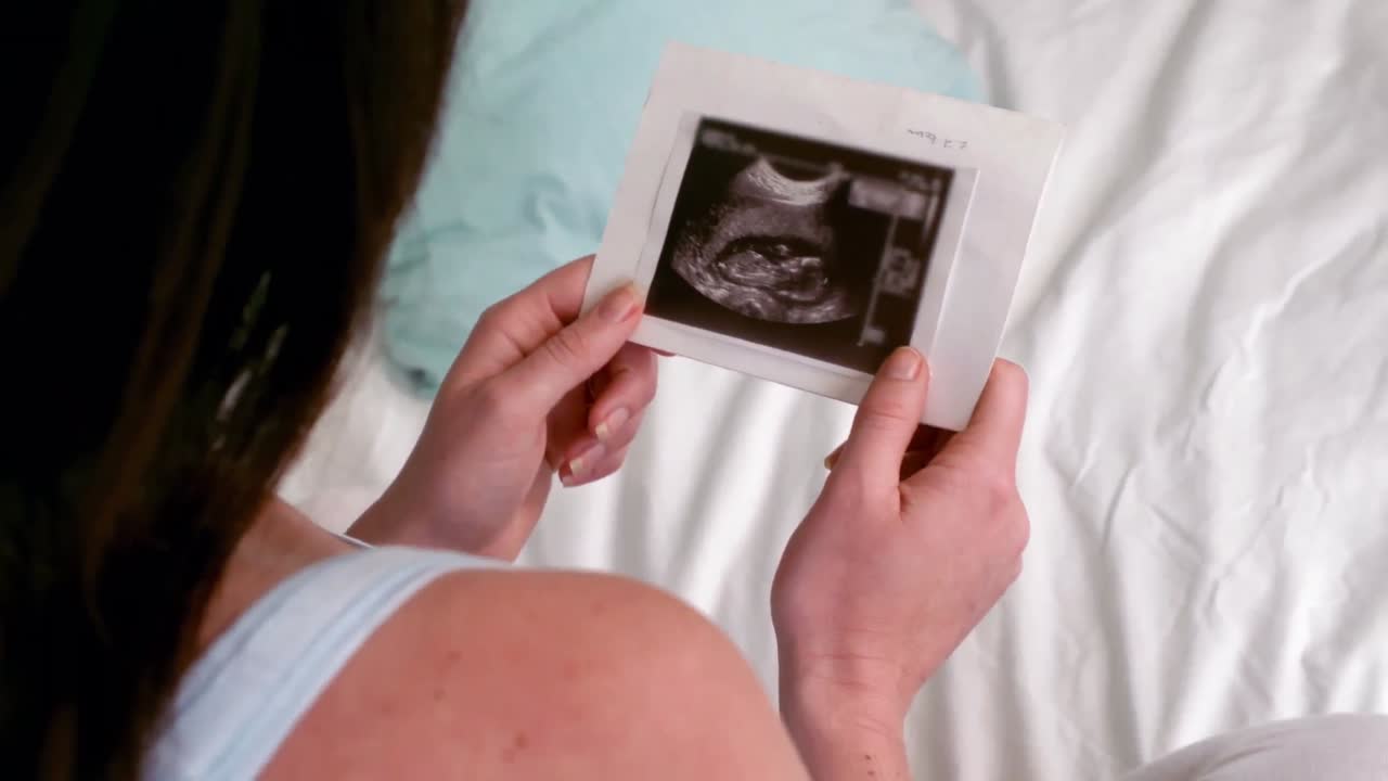 Donna incinta che guarda l'ecografia