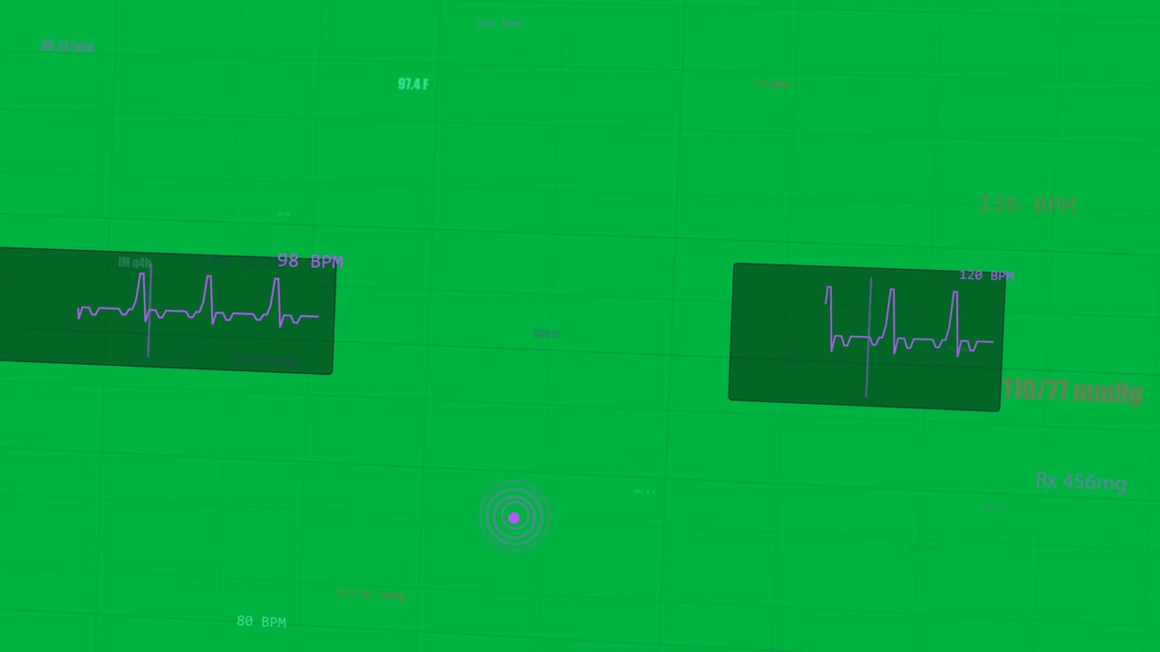 HUD sanitario con picco di dati, panoramica e aggiornamento ECG per monitorare i parametri vitali, sfondo trasparente