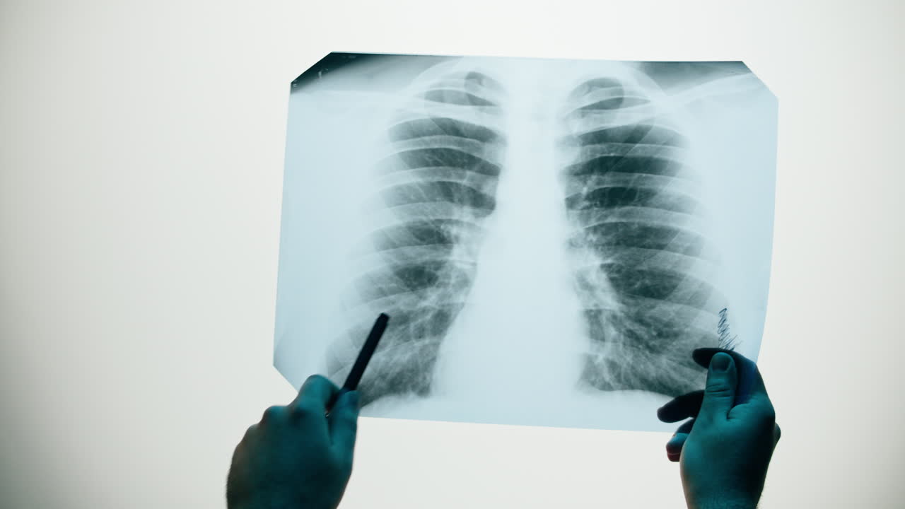 Professionista medico che analizza una radiografia dei polmoni umani