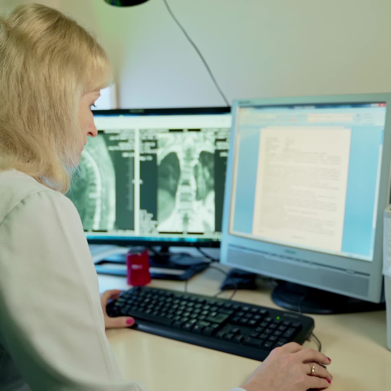 Doctor sitting her back to the camera typing the conclusion on results of tomography. Computer screen with MRI shots at backdrop