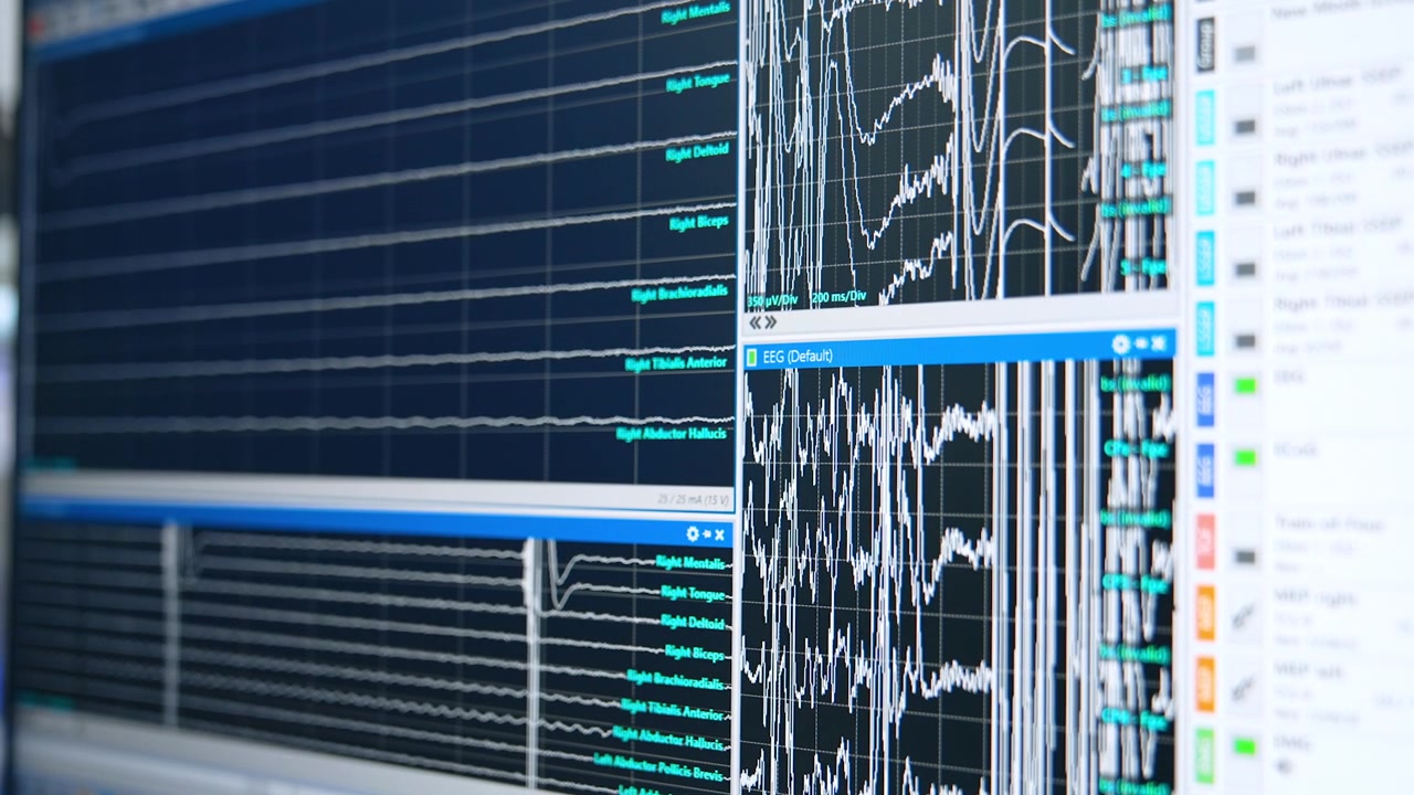 Real-time EEG and EMG Brain Activity Data on Computer Screen