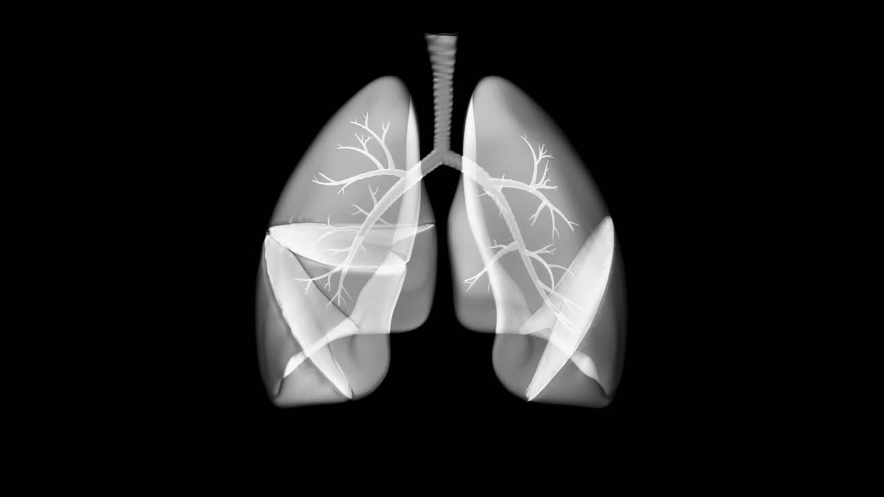 Medical animation of human lungs with visible bronchi rotating on black background. X-ray or MRI style for health concepts