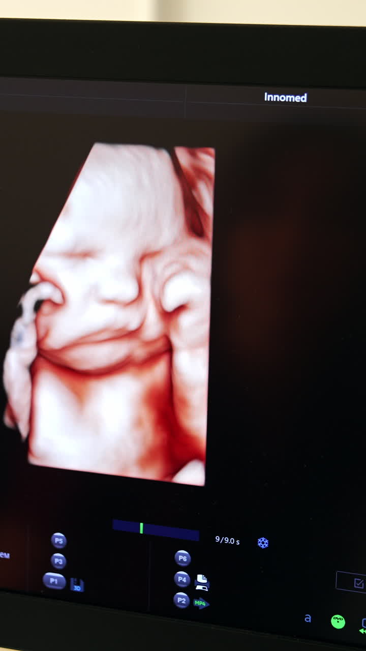 Adorable prenatal baby picture on the screen of ultrasound apparatus. Unborn baby holding his little fists at the face.