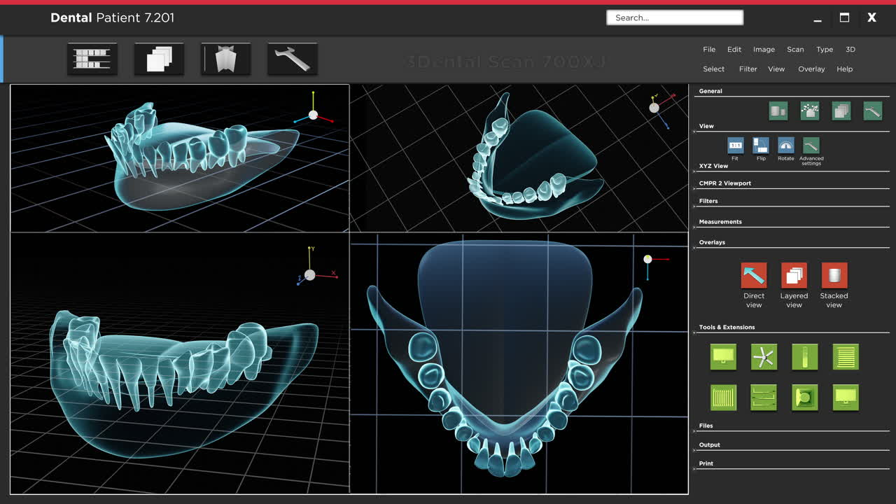 3D Dental Scan