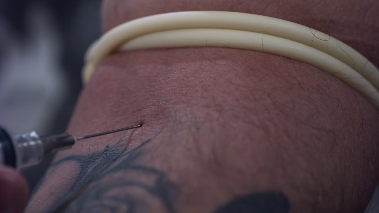 Macro shot of a hypodermic needle sticking into an adult male's forearm veins