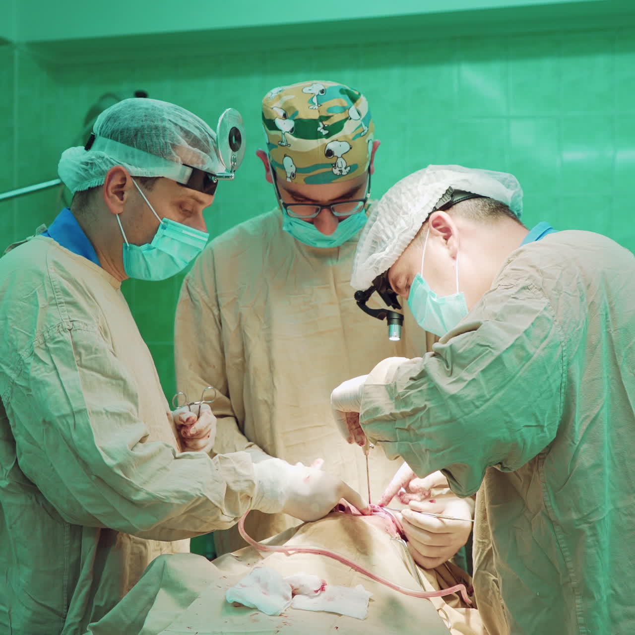 Three professional surgeons men and assistant woman are making an operation in clinic. Team of doctors perfom the operation on a patient in the hospital operating room.