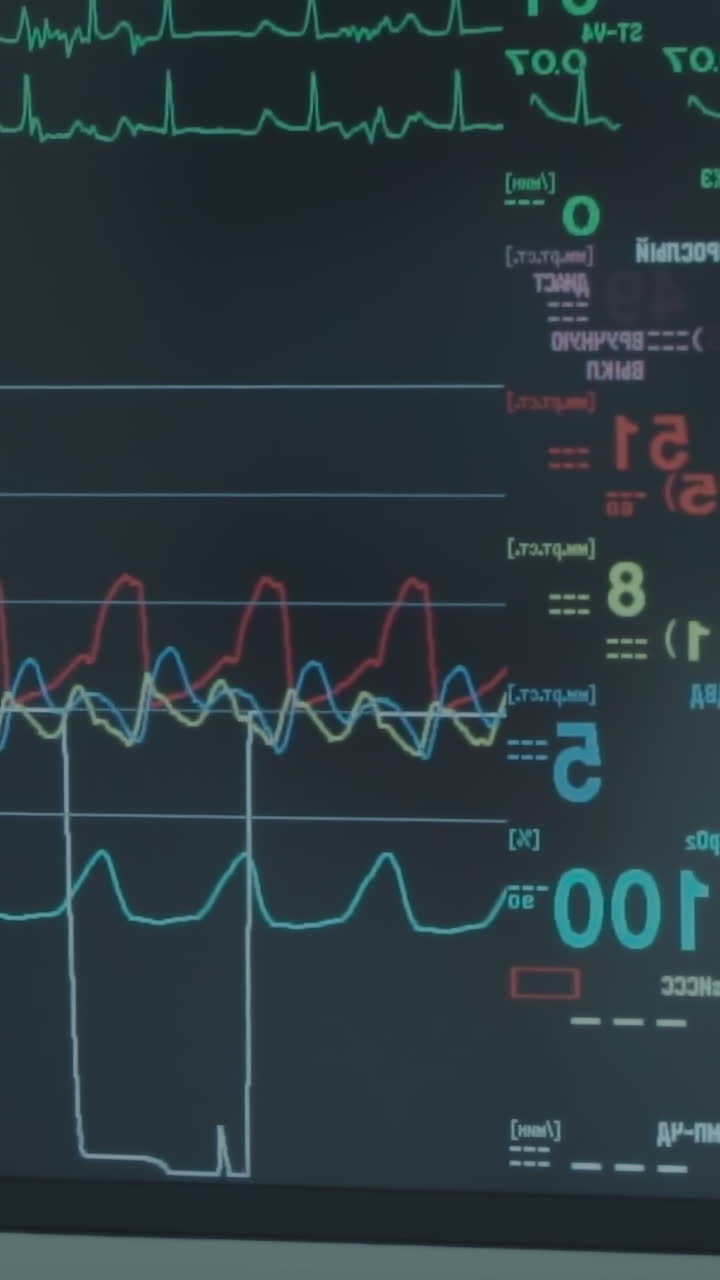 이 스크린은 환자의 생명 지표를 표시합니다. 심장 데이터는 실시간으로 수술실의 디지털 스크린에서 관상동맥 바이파스 수술 중에 모니터링됩니다.