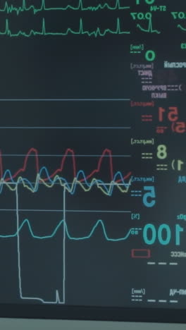 pantalla muestra los indicadores de vida del paciente. datos cardíacos en tiempo real monitoreados en pantalla digital en la sala de cirugía durante la cirugía de derivación de la arteria coronaria