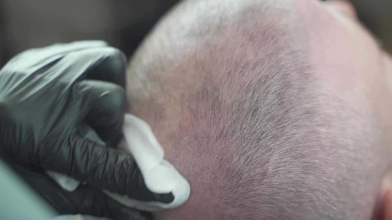 Man in micropigmentation treatment