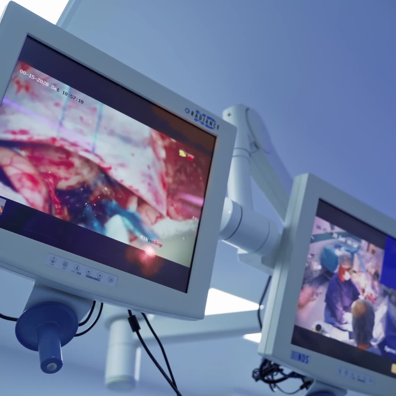 Team surgeon at work in operating room. Modern equipment in operating room. Medical devices for neurosurgery