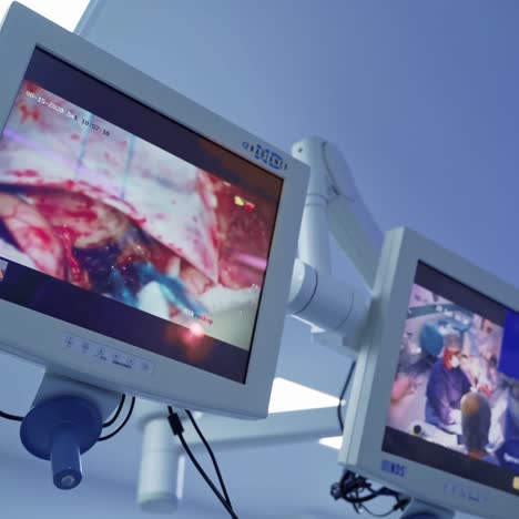 team surgeon at work in operating room. modern equipment in operating room. medical devices for neurosurgery