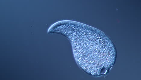 microscopic view of a ciliate protozoan