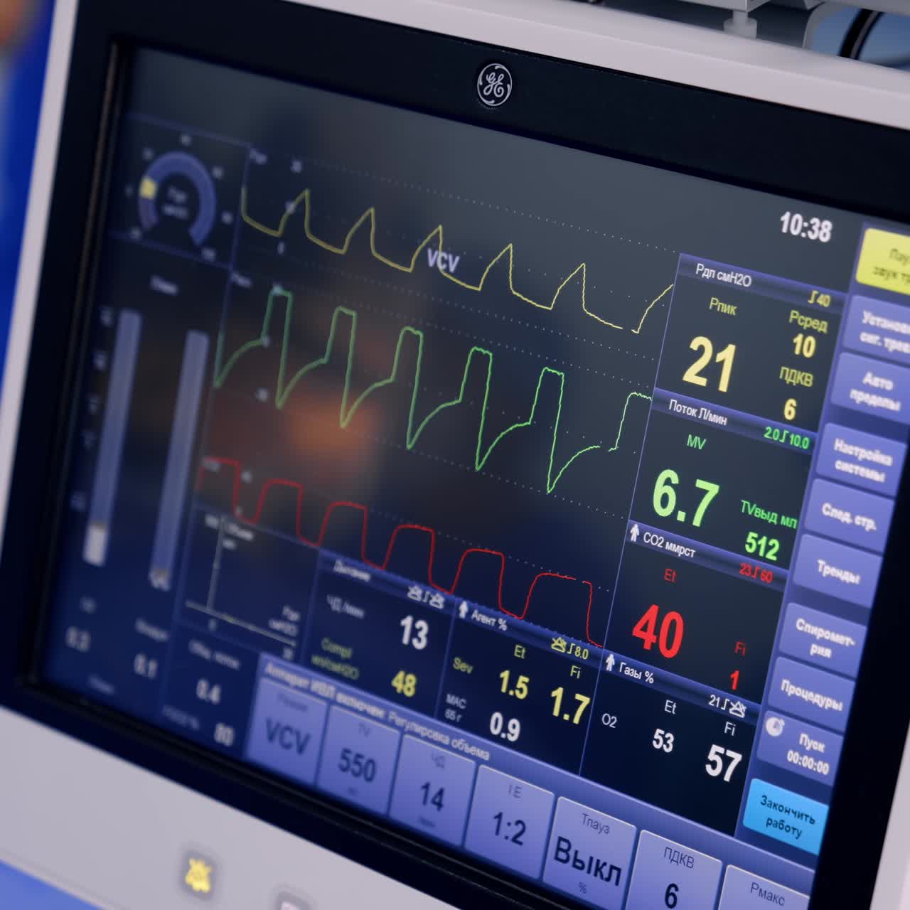 Segni vitali di una persona sotto intervento chirurgico sul monitor di un ventilatore polmonare. Primo piano. Pistone della macchina che sale e scende.