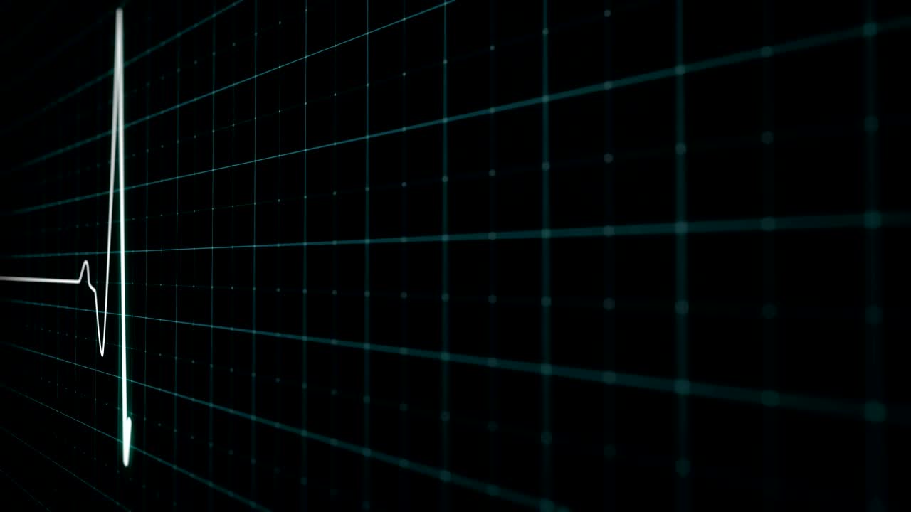 ecg 스크린, 백색 심장 박동 선, 클로즈업