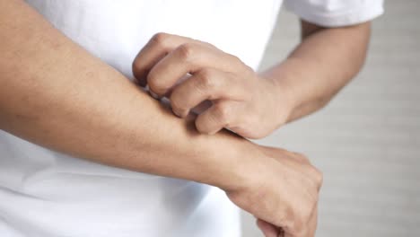 persona con picazón en el brazo