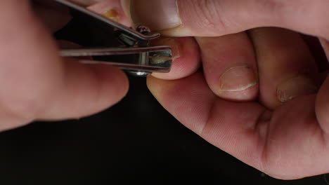 close-up of toenails with fungal infection, clipped and shown against a black background.