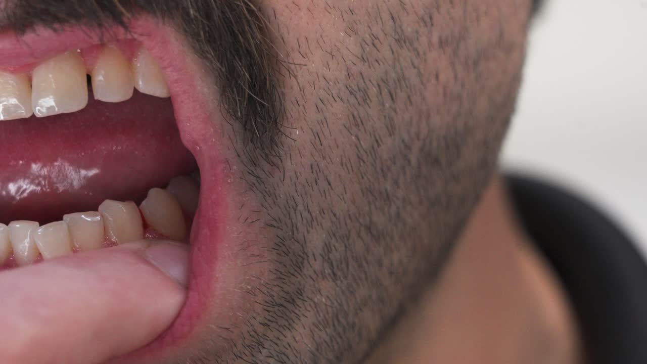 Close up look at a dark haired beard stubble on a 20 something