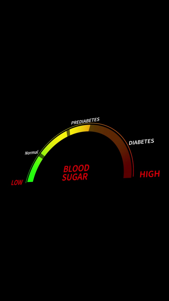 Animazione medica di un indicatore di glicemia con zone attive per basso, normale, prediabete, diabete e alto.