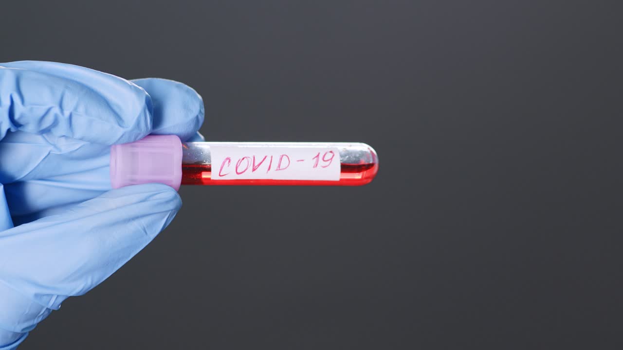 test del sangue per il covid-19