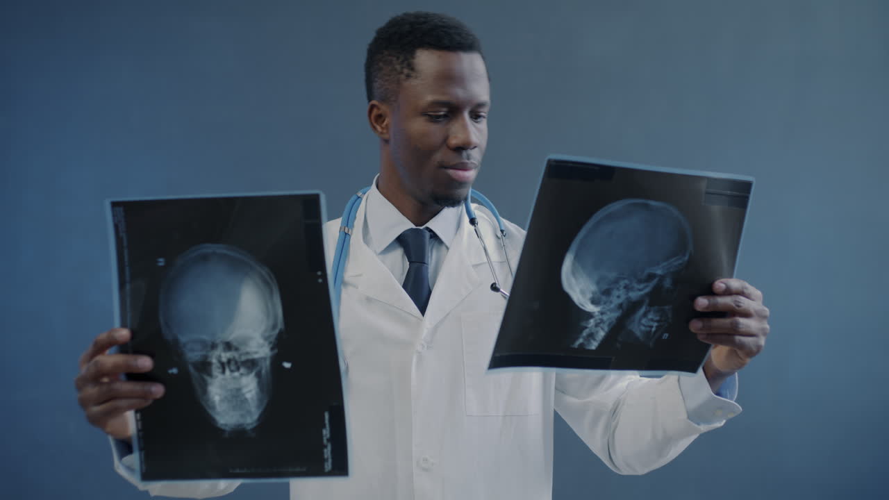 Doctor Reviewing Skull X-rays