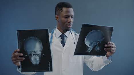 doctor reviewing skull x-rays