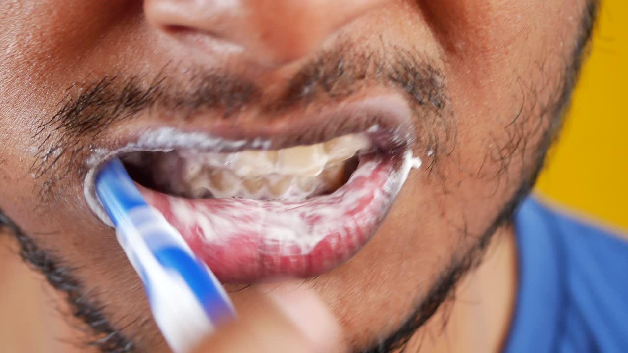 치아를  ⁇ 는 남자