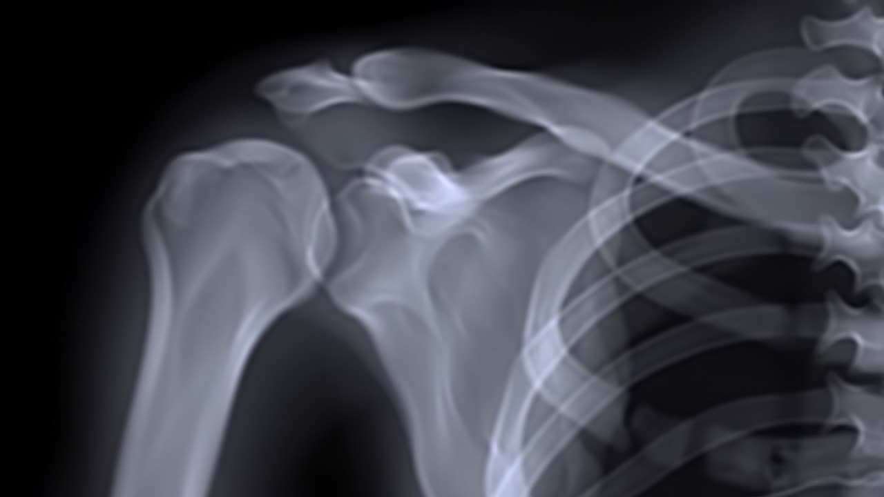 This educational content explores the intricate structure of the human shoulder via X-ray imaging, showcasing bone connections and joint alignment.